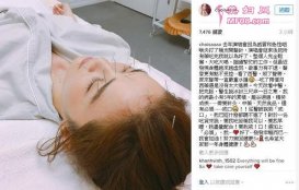 阿Sa满脸插针吓坏粉丝 声带已严重水肿