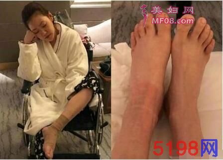 40岁黄奕减肥成功颜值回春，正式告别过去！网友：与女儿好好生活！