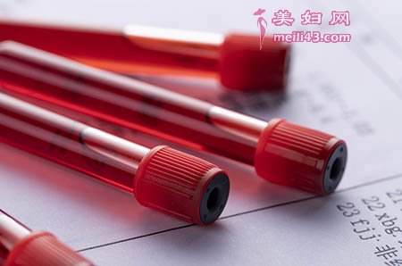 产后盆骨带有用吗 及时护理最关键4