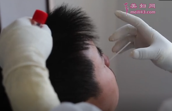 咽拭子
